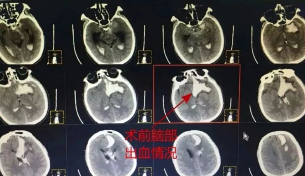 灵堂都搭好了男子却死而复生，百闻不如一见的奇闻