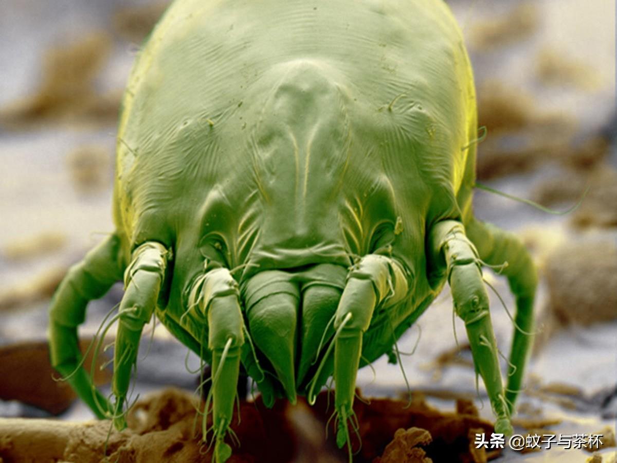 显微镜下的螨虫世界！人体只不过是微型生物的巨型战场