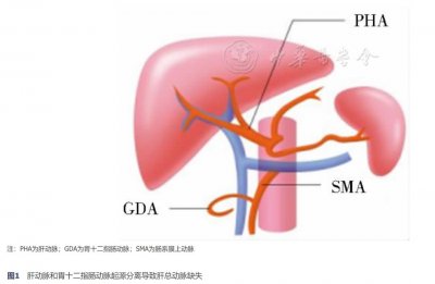 ​腹腔干分支及分型的研究进展